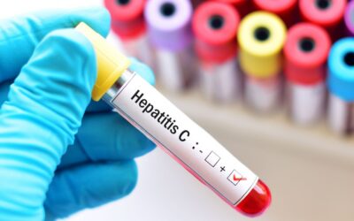 Argentina registra entre 700 y 800 casos de Hepatitis C cada año